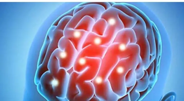 Descubrimiento: terapias frenarían el envejecimiento cerebral