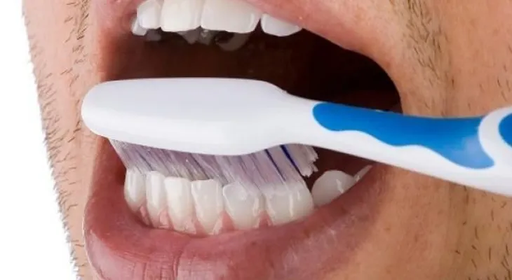 ¿Qué es la hipoplasia o alteración color del diente?