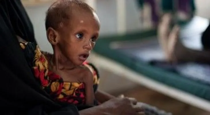 Cantidad de niños raquíticos en África va en aumento, dice informe OMS 