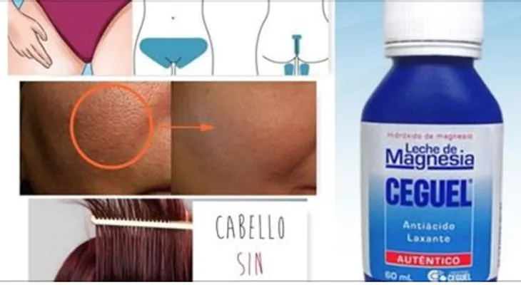 La leche que actúa como una "magia blanca" en la piel: También es ideal si tiene estreñimiento 