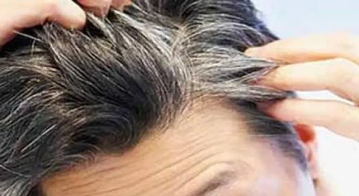 Las canas no aparecen por estrés, la culpa es de tu genética