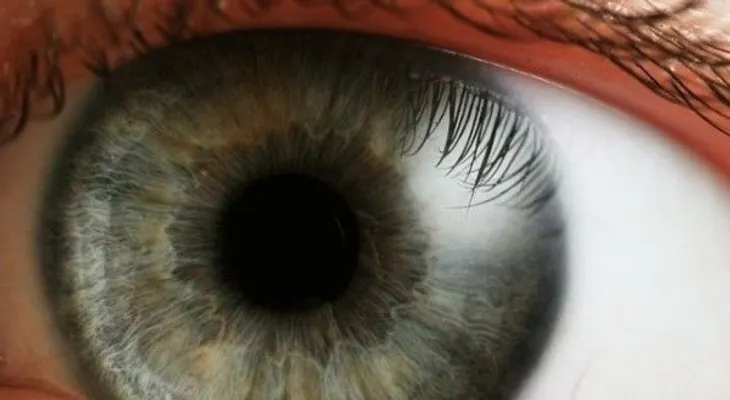 ¿A qué se debe la visión borrosa y cómo tratarla?