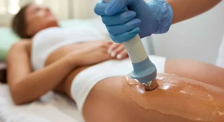 5 teorías sobre la celulitis que no son reales
