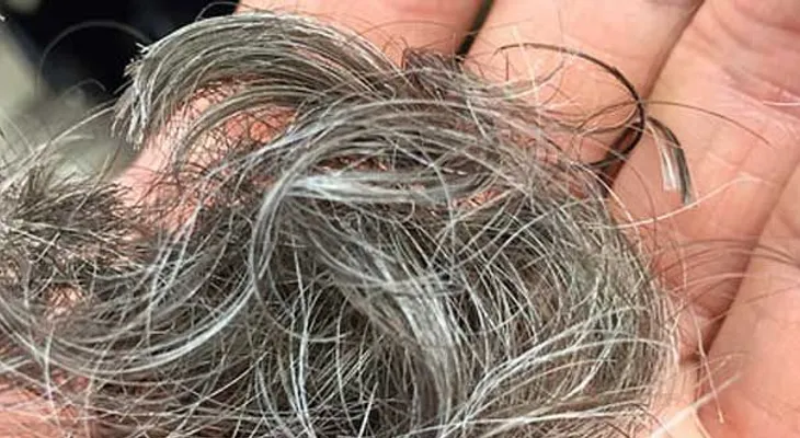 Las canas pueden aparecer por algunas enfermedades; cómo retrasar su aparición