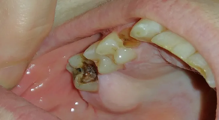 Toma esta medicina y tus dientes empezaran a repararse por sí mismos y siempre estarán sanos y libres de sarro y caries! ¡sensacional!