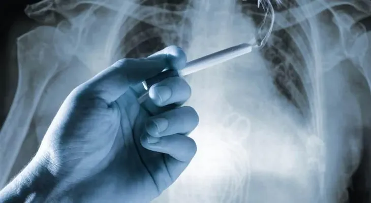 Estudio revela, 64% casos cáncer de pulmón son causados por el tabaco; evita ser una próxima víctima