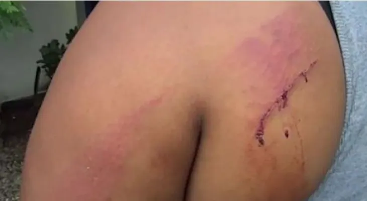 Una mujer denuncia que un hermano intentó matarla a machetazos 