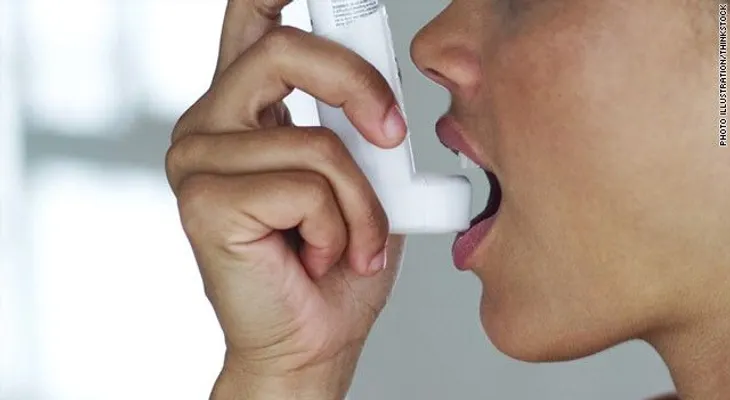 ¿Vives en el trópico y sufres de asma severa? Podría ser que tu microbiota está alterada