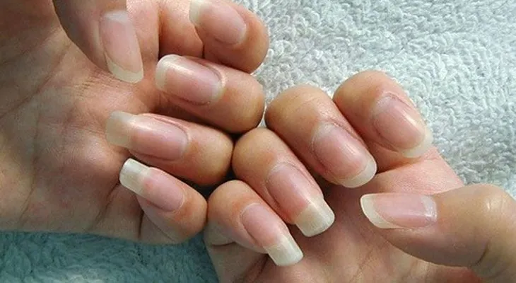 Si una de tus uñas tiene una media luna, tiene que verlo rápido, porque se trata de algo importante