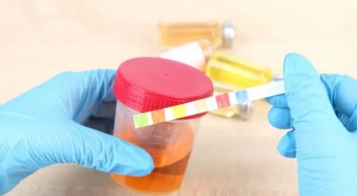 Dicen diagnóstico del zika es más efectivo en análisis de orina