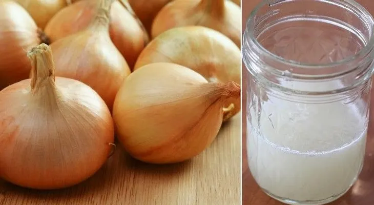 Jugo de cebolla para la caída del cabello