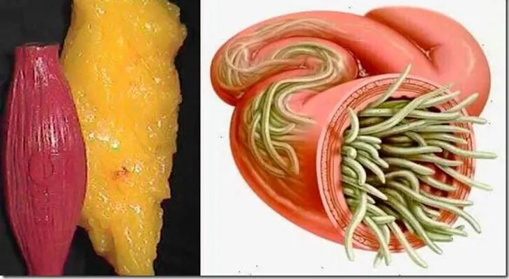 Con estos 2 ingredientes vacié todos los depósitos de grasa y parásitos de mi cuerpo como si nada