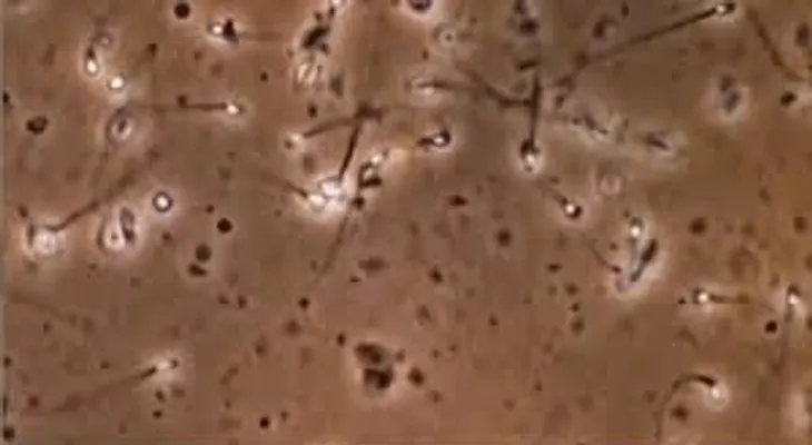 Spermbot: un robot que ayuda a los espermatozoides a fecundar el óvulo (VIDEO)
