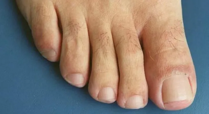 El mal olor de los pies podria combatir la malaria