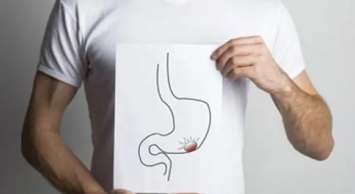 Tumores benignos de cáncer de estómago