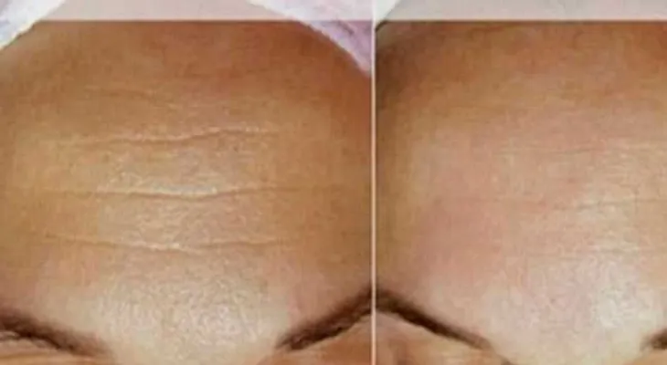 ¿Conoces la Crema 4? Esta crema limpia, aclara, suaviza y quita las arrugas ¡4 Ingredientes, 4 Beneficios!