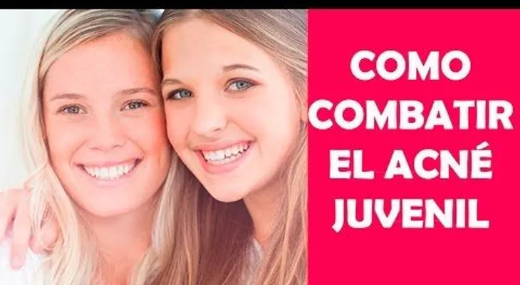 Consejos para eliminar el acne en la Adolecencia