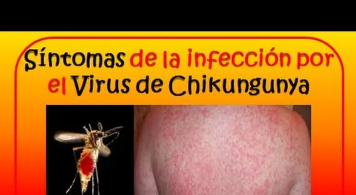 El mosquito hembra transmite la chikunguña; efectos enfermedad pueden durar hasta dos años