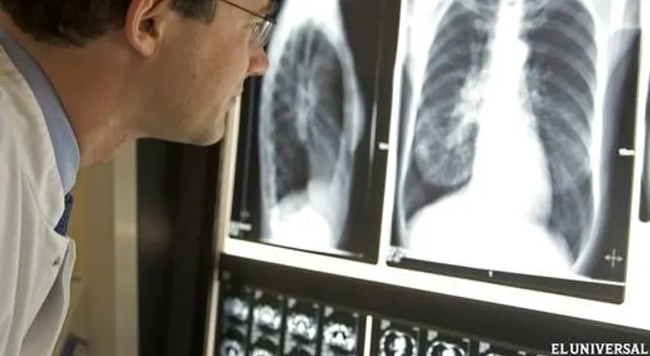 Enfermedad respiratoria cuarta causa de muerte en niños en el mundo