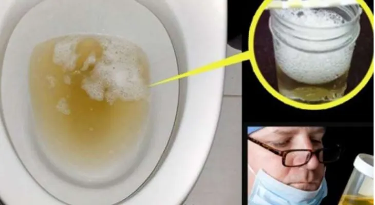 URGENTE a un médico si orina más espumoso de lo normal
