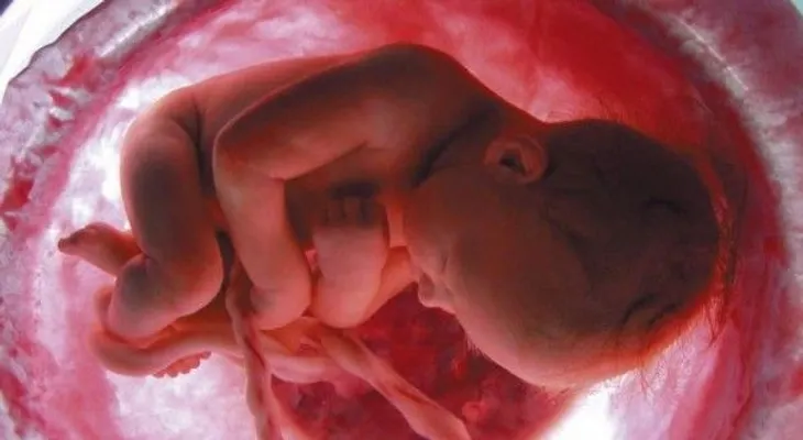 Un estudio confirma los beneficios de retrasar pinzamiento del cordón umbilical