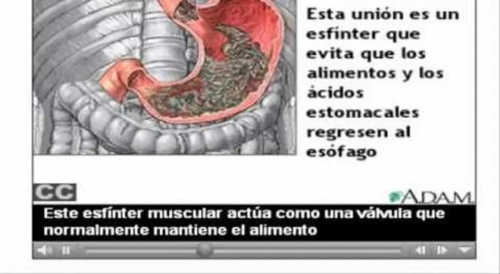 Acidez gástrica (VIDEO)