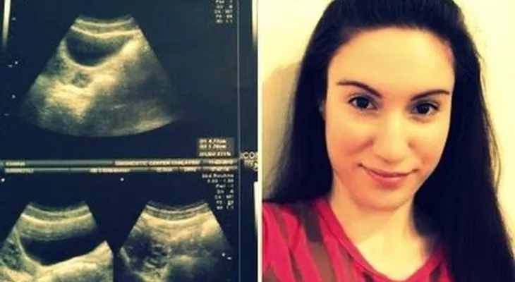 Una chica nace sin vagina y sin útero cuenta su historia