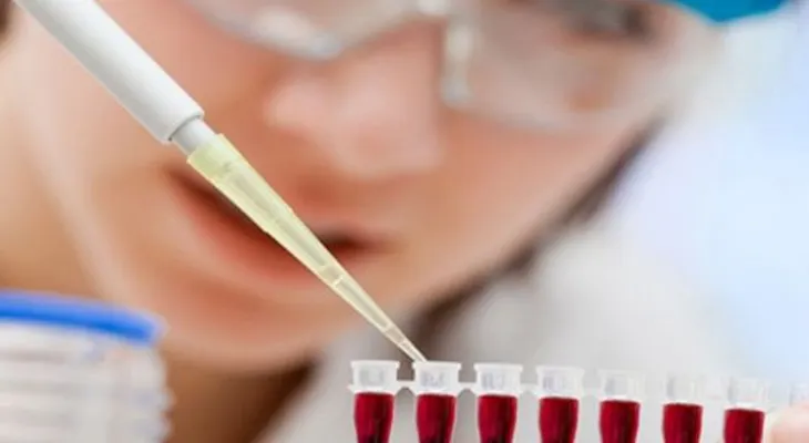 Prueba de ADN de la sangre es más eficaz para detectar síndrome de Down
