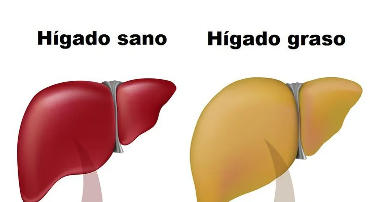 8 bebidas nocturnas para desintoxicar hígado y quemar grasas