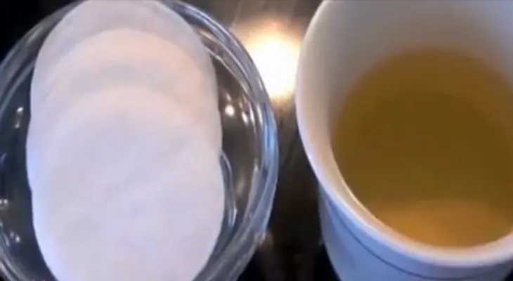 Esto te servirá para quitar manchas y pecas y dejar una piel perfecta