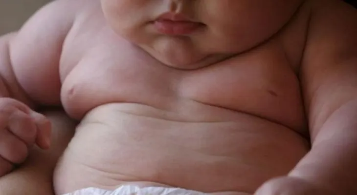 ¡Alerta! 41 millones de niños menores de cinco años son obesos