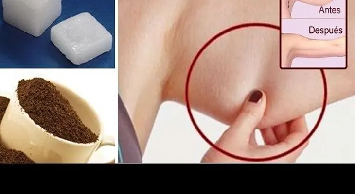 La flacidez de los brazos, el  mejor remedio para eliminarla 