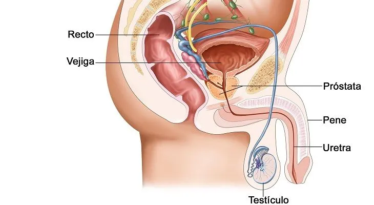 El cáncer de pene, una enfermedad poco conocida; tratamiento