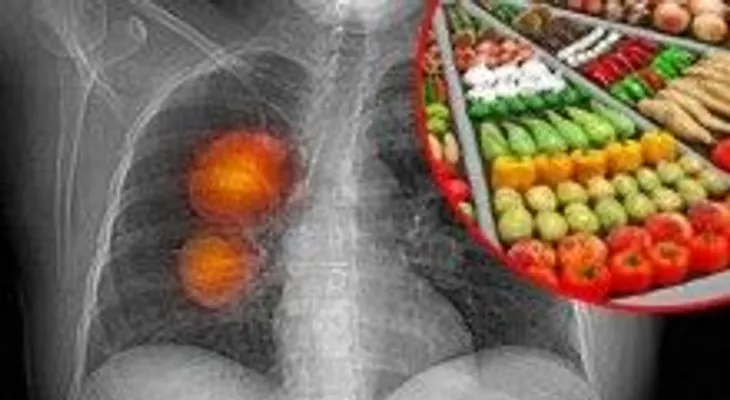 RECETA para limpiar tus pulmones en sólo 3 días! 
