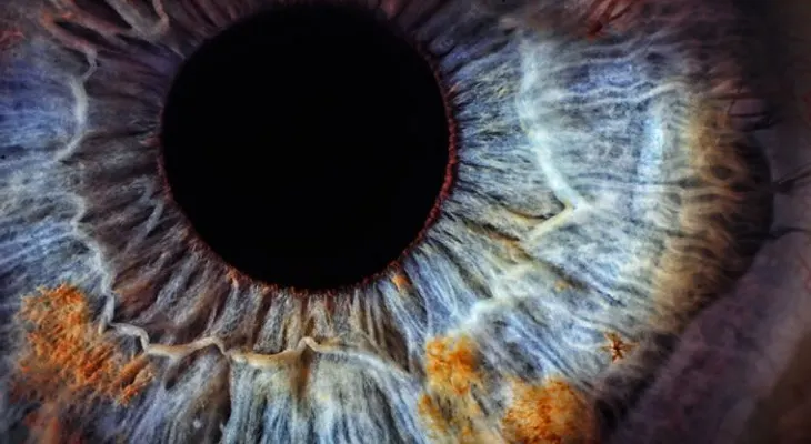 El asombroso síndrome del Ojo Fantasma