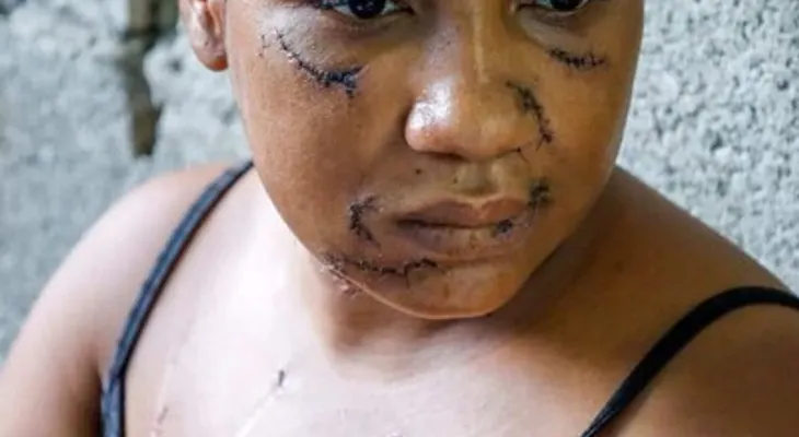 Nayely, madre de tres niñas, sobrevive a 26 estocadas en La Vega y su agresor es enviado a prisión preventiva
