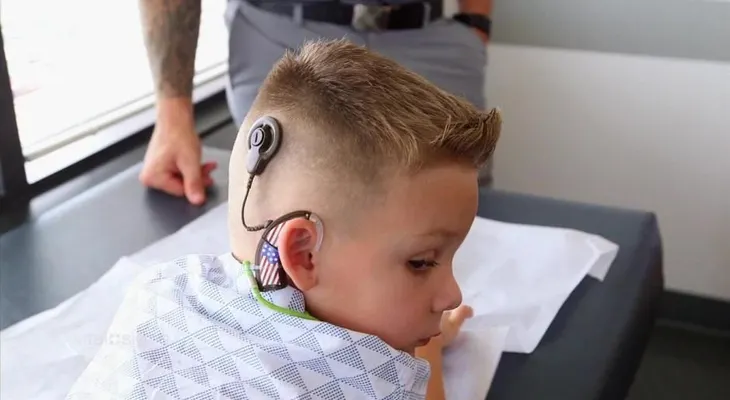 Un oído biónico permite que un niño sordo escuche por primera vez