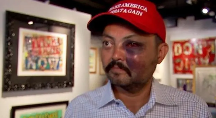 Un hombre recibe una brutal golpiza por usar gorra de Trump; dominicanos condenan agresión 