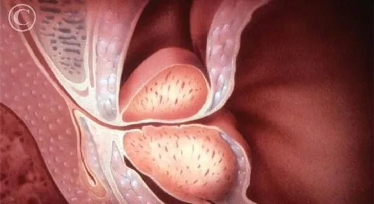 Médicos españoles localizan gen favorece resistencia cáncer de próstata