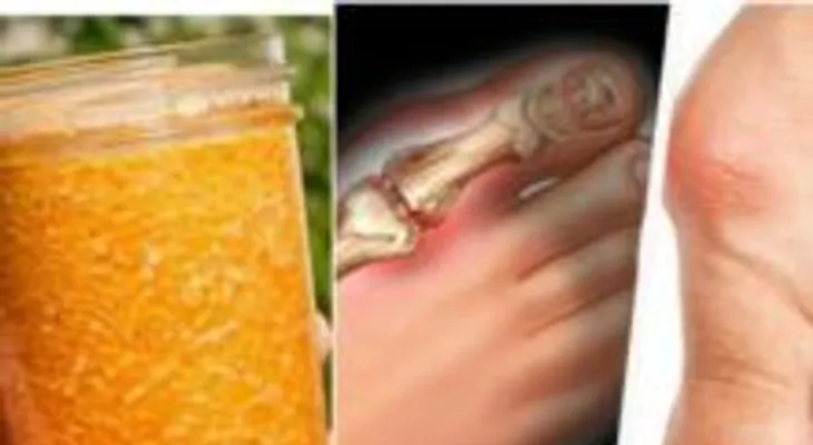 Un especialista de salud le recomendó este jugo para aliviar las inflaciones y la gota y dejó de usar medicamentos 