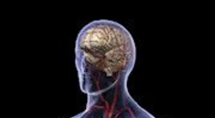 Factores de riesgo cerebrovascular  (VIDEO)