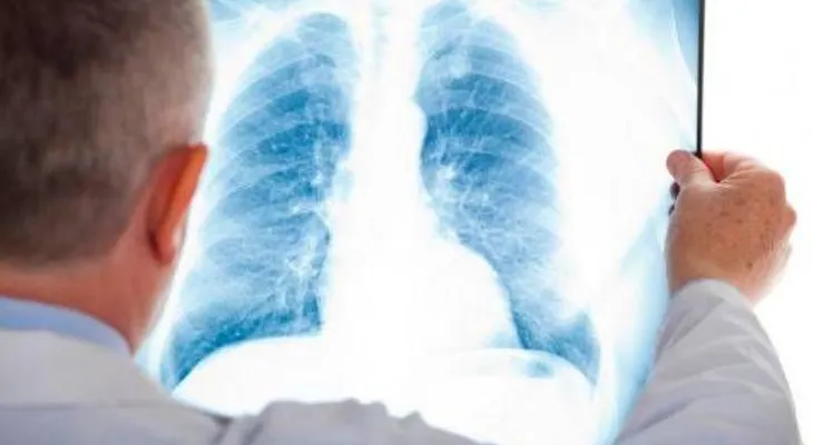 Seis recomendaciones para pacientes con hipertensión pulmonar en época de Covid-19