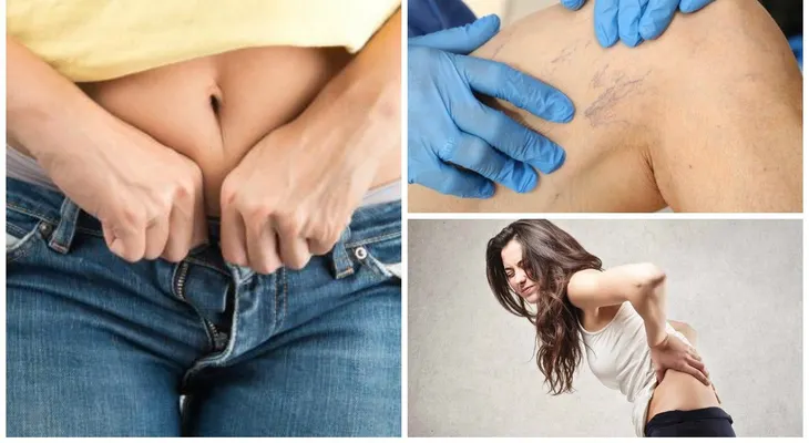 Personas que usan ropa muy ajustada pueden tener problema con sus órganos sexuales, la espalda y la circulación 