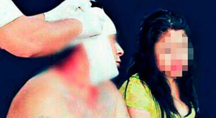 Esposa le da un fuerte botellazo a su pareja durante un trío porque sólo atendía a la otra mujer 