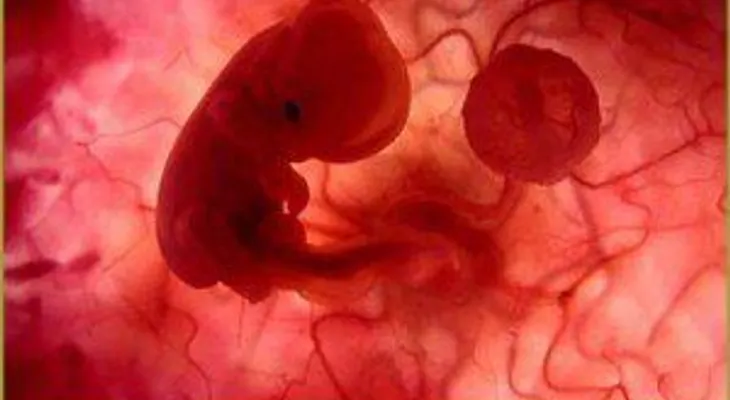 Relator de la ONU sobre salud pide a Paraguay despenalizar el aborto