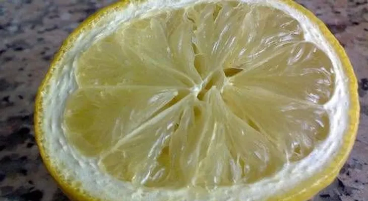 Importantes remedios caseros contra la estrias
