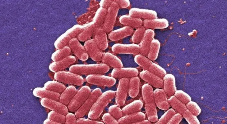  Investigadores en EE.UU. descubren una nueva infección resistente al antibiótico más potente del mundo 