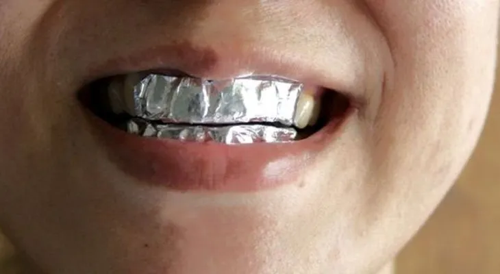 En 15 minutos cubrió sus dientes con papel de aluminio ¡El resultado fue sorprendente !