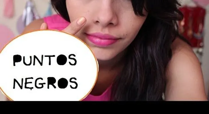Dile ADIOS a los puntos negros con este increíble remedio 