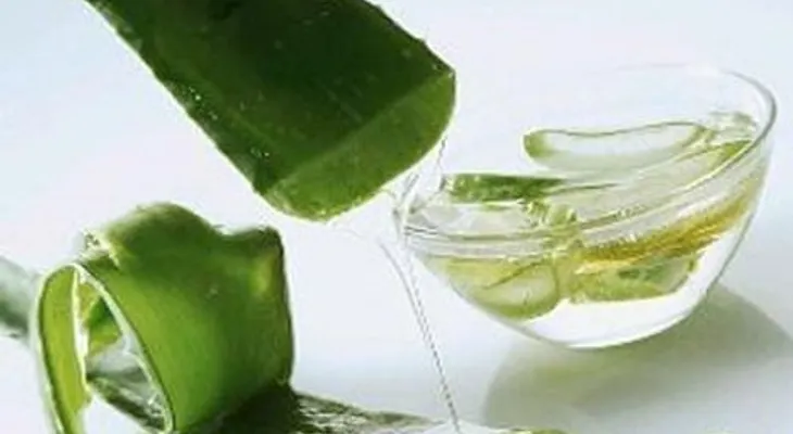 Remedio casero de aloe vera para las quemaduras
